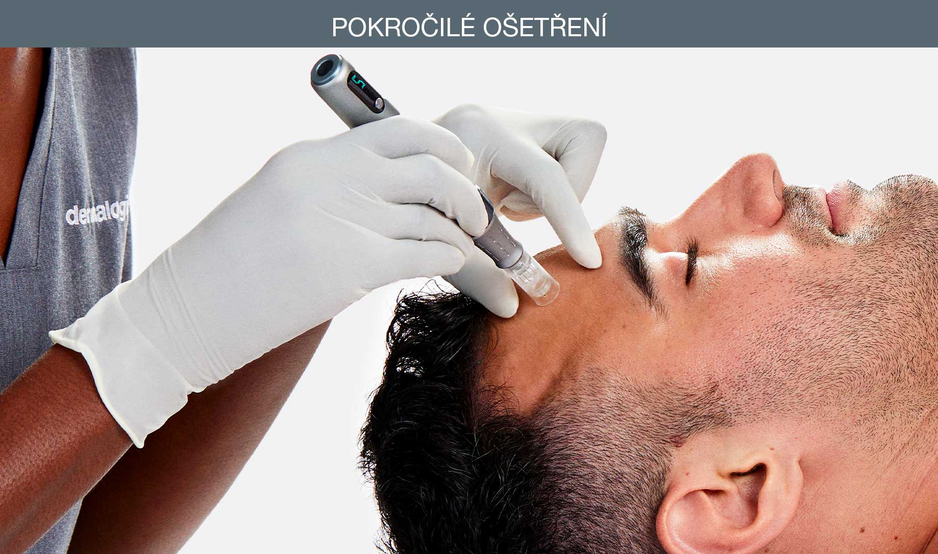 pokrocile-osetreni-pro-microneedling-dermalogica